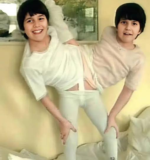 The sisters were born joined at the pelvis, but doctors separated them at age 11: This is what they look like today