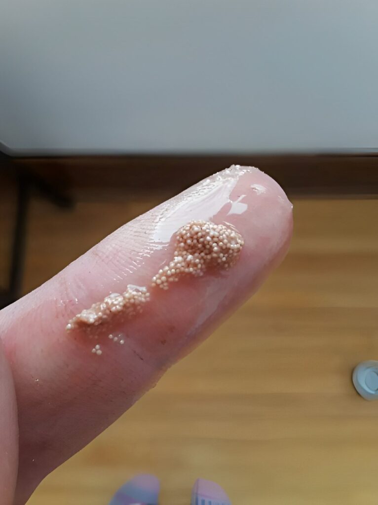 I found these small, slippery lumps inside the egg and thought they were insect eggs, but then I learned the horrible truth