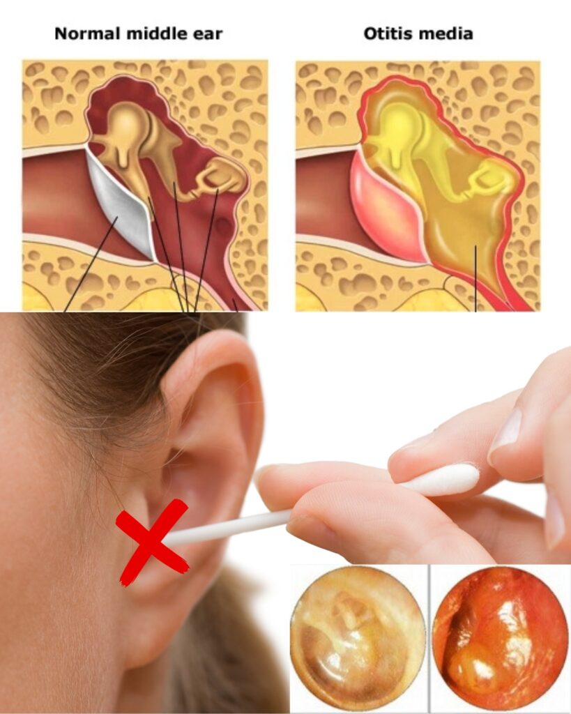 If You Keep Getting Ear Infections, Your Body Might Be Begging You to Listen đź‘‚