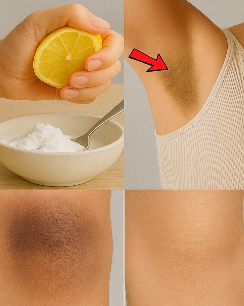 Simple Home Remedies to Lighten Dark Underarms and Knees Naturally