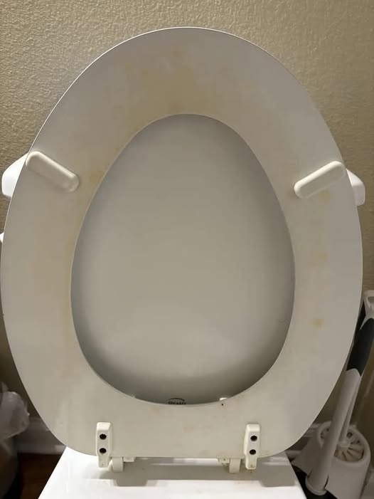 How I Successfully Removed Those Annoying Yellow Toilet Stains